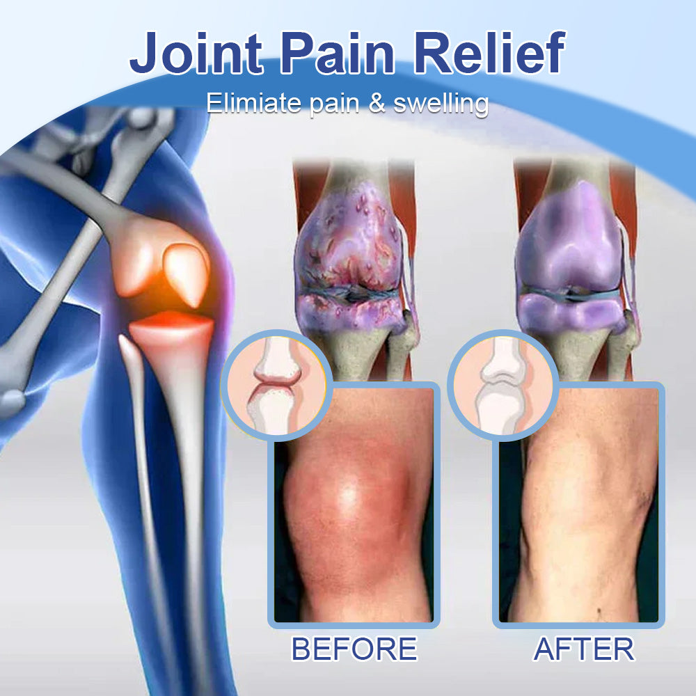✅Official Store: flysmus™ Magnesium pain relief healing cream👨⚕️Orthopaedic Association (BOA) Approved (Reducing joint pain, swelling, stiffness, redness, soreness, warmth,and joint fatigue)