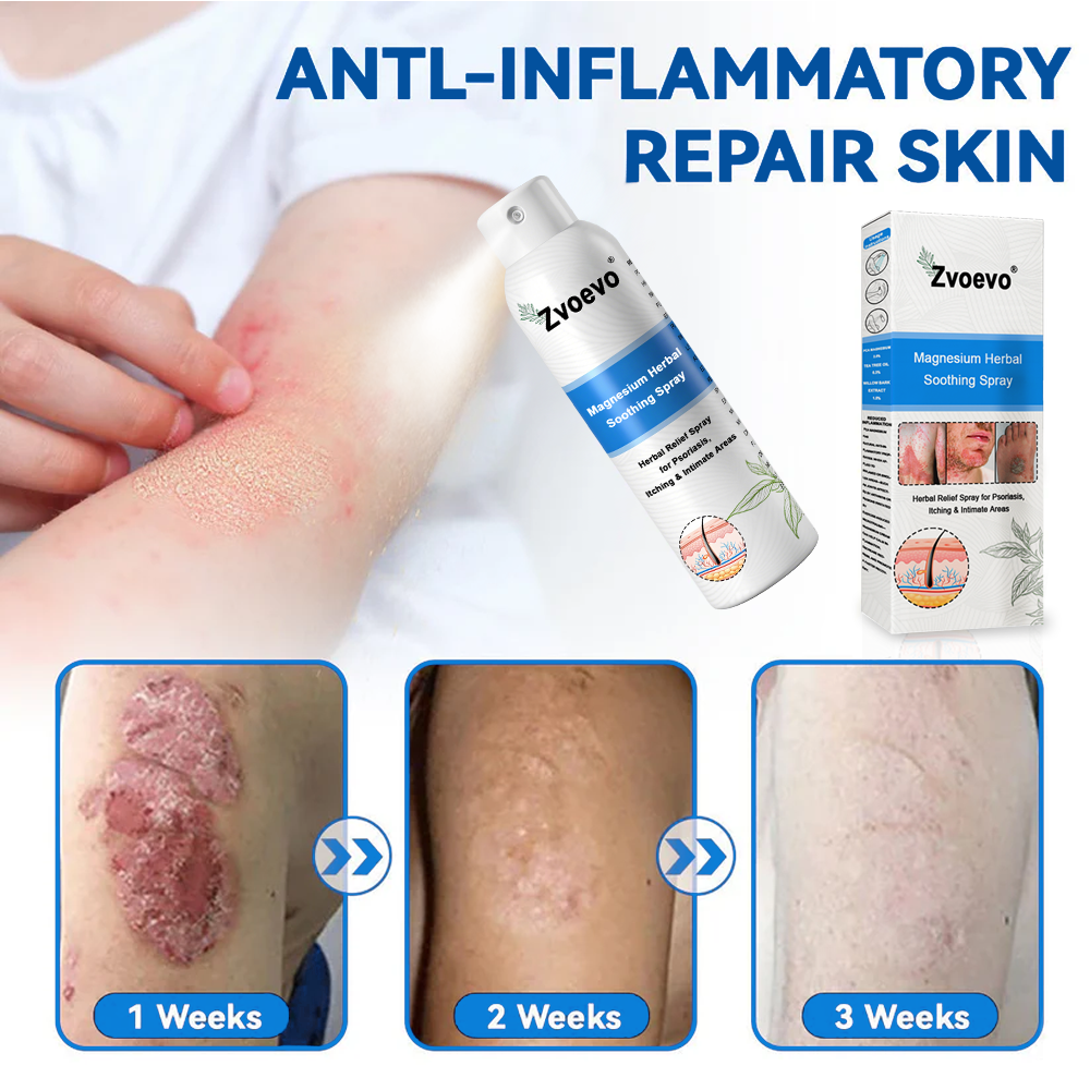 ✅Official Store: Zvoevo®Magnesium Herbal Spray⚕️MHRA Approved(Relief for Psoriasis and Eczema, Improvement of Bacterial Infections in the Genital Area, and Treatment of Acne and Dark Spots)
