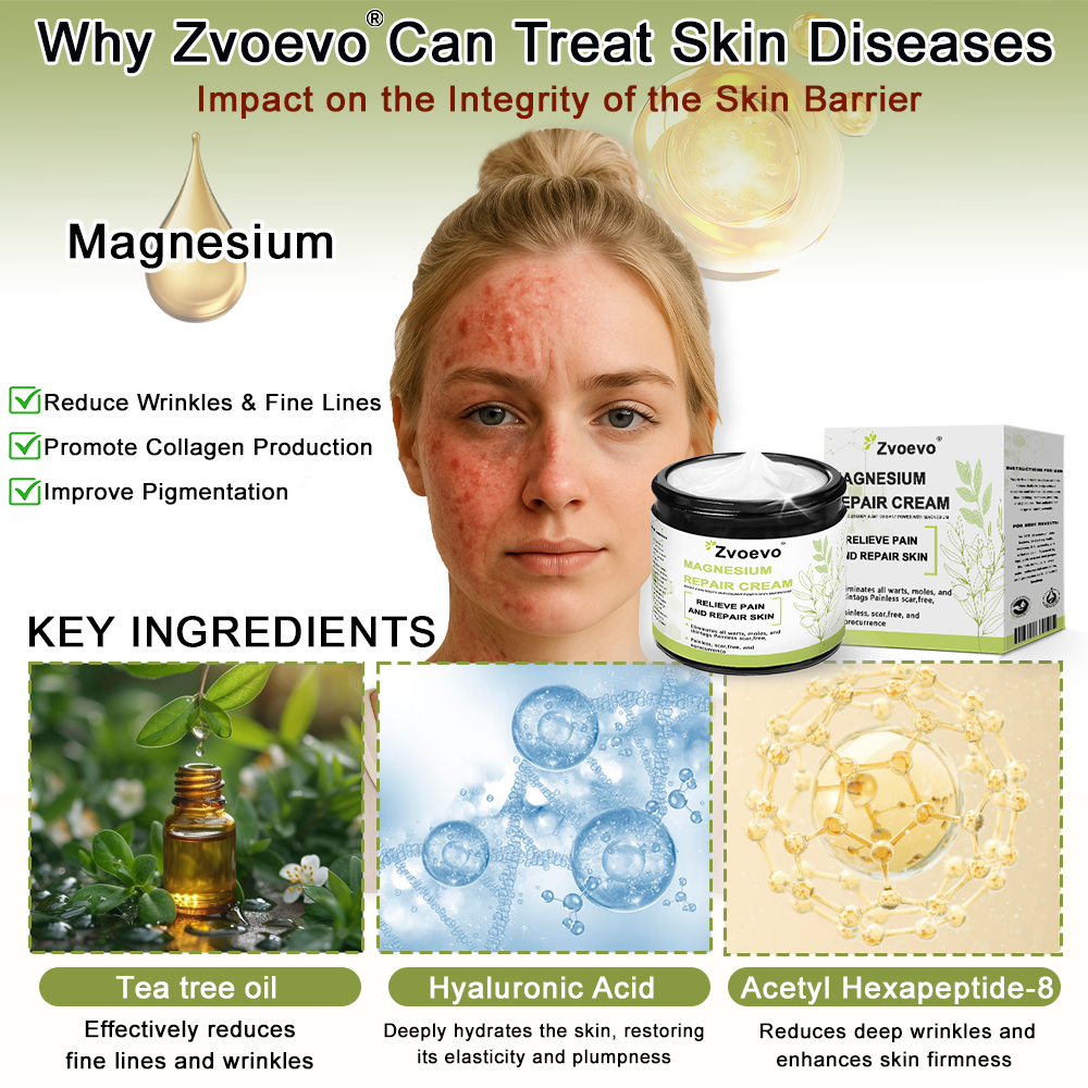 ✅ Official Store: Zvoevo® Magnesium Natural Repair Cream ⚕️ MHRA Certified – (Relief for Psoriasis, Eczema, Joint & Nerve Pain, Skin Repair, Even Tone, Acne & Dark Spot Treatment, Wart & Skin Tag Removal)