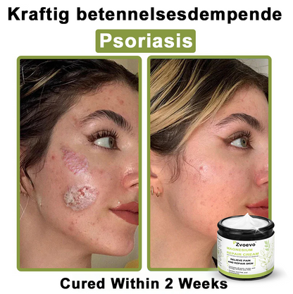✅ Official Store: Zvoevo® Magnesium Natural Repair Cream ⚕️ MHRA Certified – (Relief for Psoriasis, Eczema, Joint & Nerve Pain, Skin Repair, Even Tone, Acne & Dark Spot Treatment, Wart & Skin Tag Removal)
