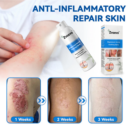 ✅Official Store: Zvoevo®Magnesium Herbal Spray⚕️MHRA Approved(Relief for Psoriasis and Eczema, Improvement of Bacterial Infections in the Genital Area, and Treatment of Acne and Dark Spots)